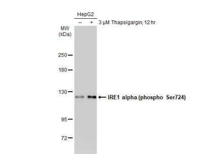 Western Blot: IRE1 alpha [p Ser724] Antibody [NBP3-12124]